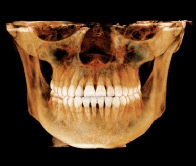cbct