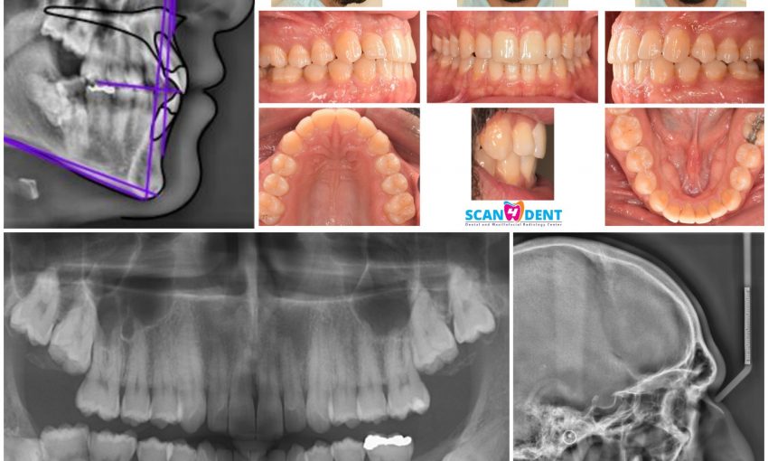 ortho file